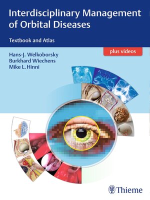 cover image of Interdisciplinary Management of Orbital Diseases